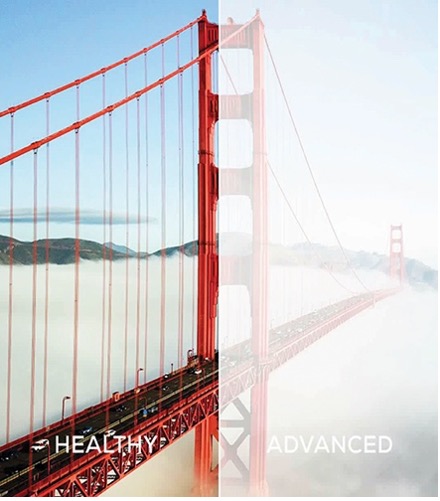 A side by side photo of the golden gate bridge comparing someone that has normal vision and one that has cataracts.